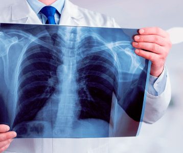 Nota de Corte Radiologia