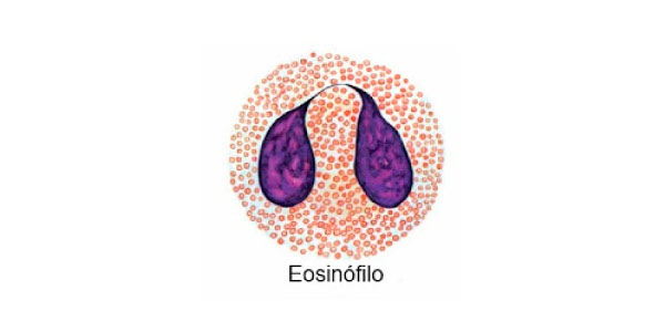 eosinófilo