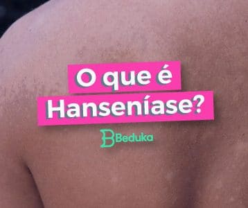 Entenda de uma vez por todas o que é Hanseníase!