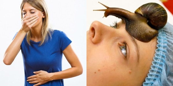 doenças-causadas-por-moluscos-squistossomose-gera-sintomas-intestinais-pessoa-com-náusea-e-mão-na-marrgia-e-irritação-na-pele-causada-pelo-muco-do-caramujo